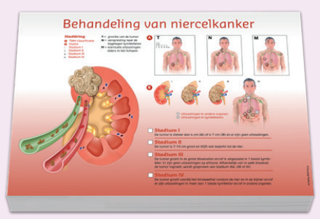 Scheurblok_niercelkanker.png